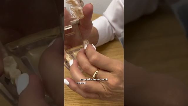 Пломбы с OZON за 300₽ смотреть онлайн