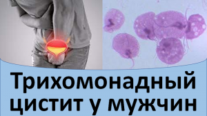 Трихомонадный цистит у мужчины