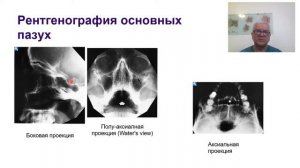 Современные методы исследования носа и его придаточных пазух