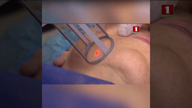 Лазерная шлифовка лица! Dr. Edgar Giniuk смотреть онлайн