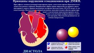 Тема 45.2. Врожденные пороки сердца – дефект межжелудочковой перегородки (ДМЖП).