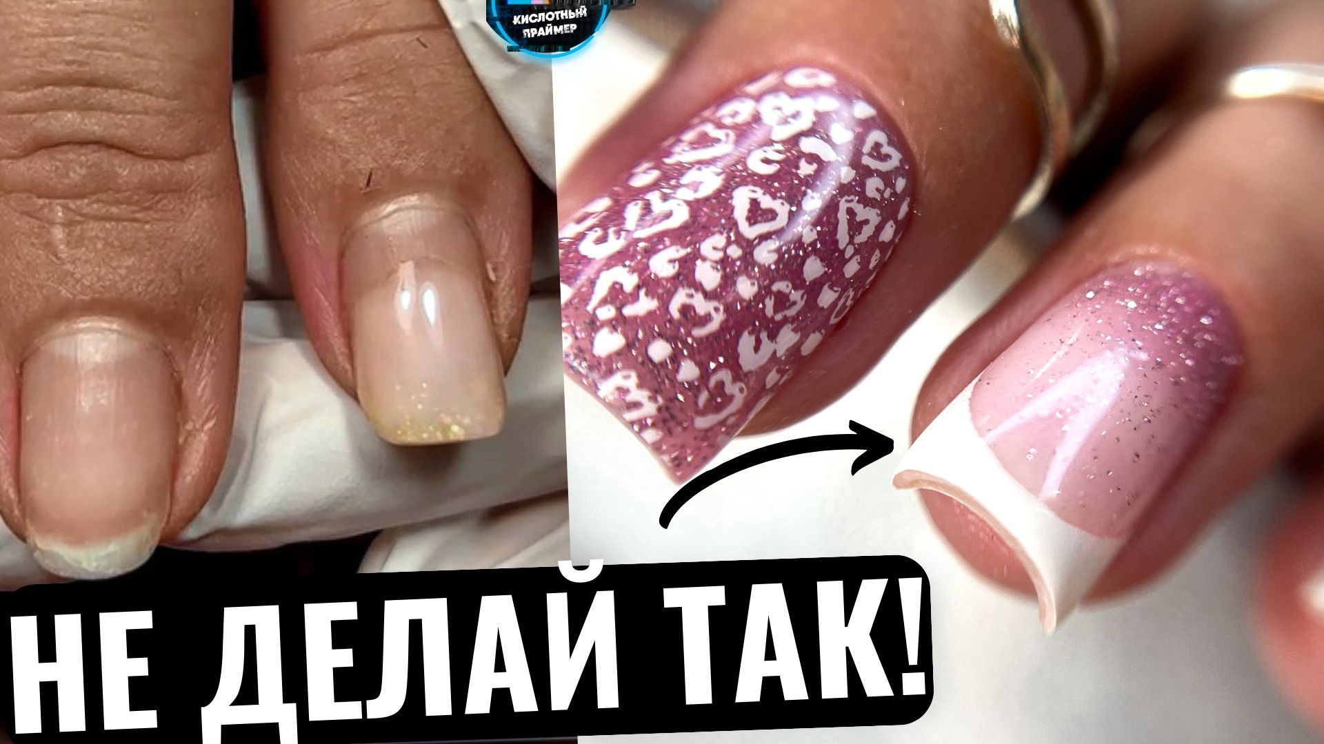 ЭТА ОШИБКА ИСПОРТИЛА МОЙ ИДЕАЛЬНЫЙ ФРЕНЧ!