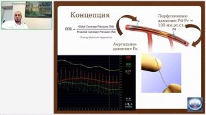 Клиническая физиология коронарного кровотока - границы ИБС