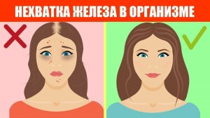 Дефицит железа в организме. Нехватка железа, как восполнить