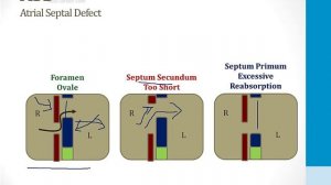 Кардиология USMLE - 7. Развивающееся Сердце - 2.Шунты