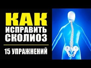 Как Исправить Сколиоз Упражнения Для Спины