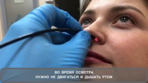 Эндоскопия носа, гибким эндоскопом.