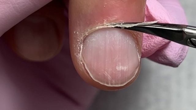 Мужской маникюр грызуна | Налипшая кутикула | Как срезать кутикулу ножницами смотреть онлайн