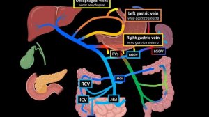 Portal Venous System & Porto-Caval Anastomosis (Tributaries and Clinical Significance) - Anatomy