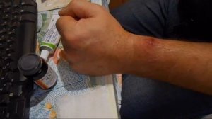 Укус кошки, обработка раны.