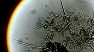 Одноклеточные водоросли под микроскопом