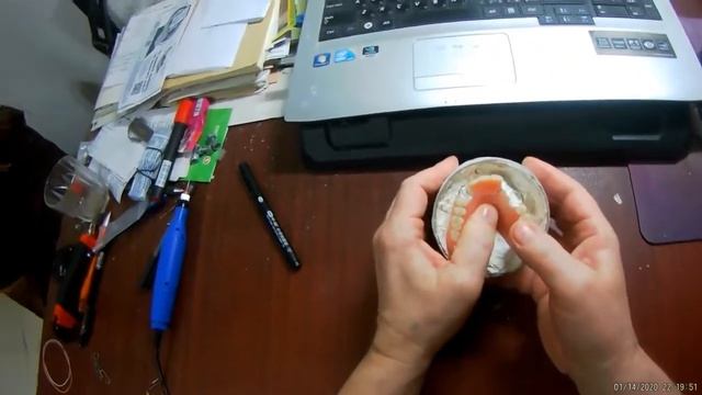 2. Ремонт акрилового зубного протеза, доступен каждому смотреть онлайн