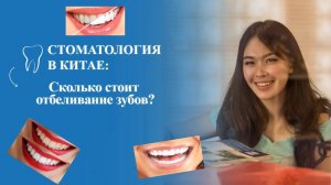 Стоматология в Китае сколько стоит отбеливание зубов?