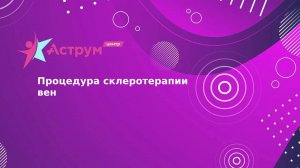 Процедура склеротерапии вен