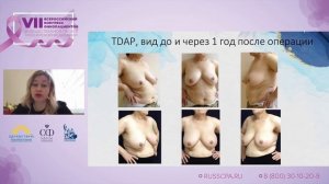 Крохина О.В. | Современные стандарты хирургического лечении рака молочной железы