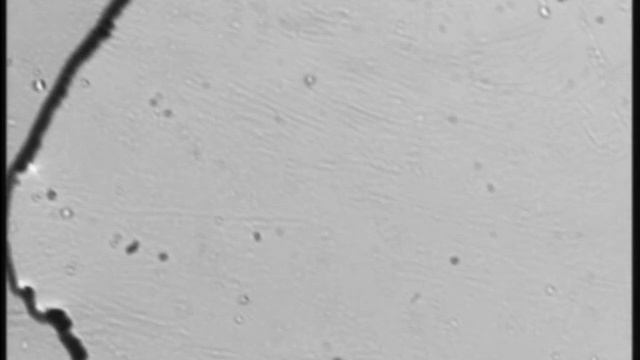 Безлинзовая шлирен-эвапорография: смесь ацетон + вода (50/50), 2 мкл смотреть онлайн