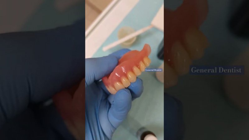 Relocation of a complete removable denture in the clinic.