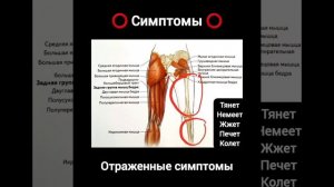 Боль в ягодице, отдает в ногу. Самомассаж #больвягодице #массаж #самомассаж