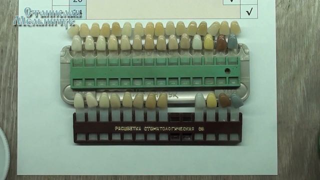 Пластмассовые зубы и облицовки. Собственная коллекция комбинаций расцветок пластмассы Синма-74. смотреть онлайн