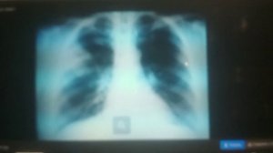 Пример описания рентгенограммы