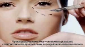 Осложнения после блефаропластики