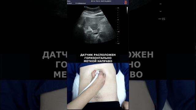 Рак печени? смотреть онлайн