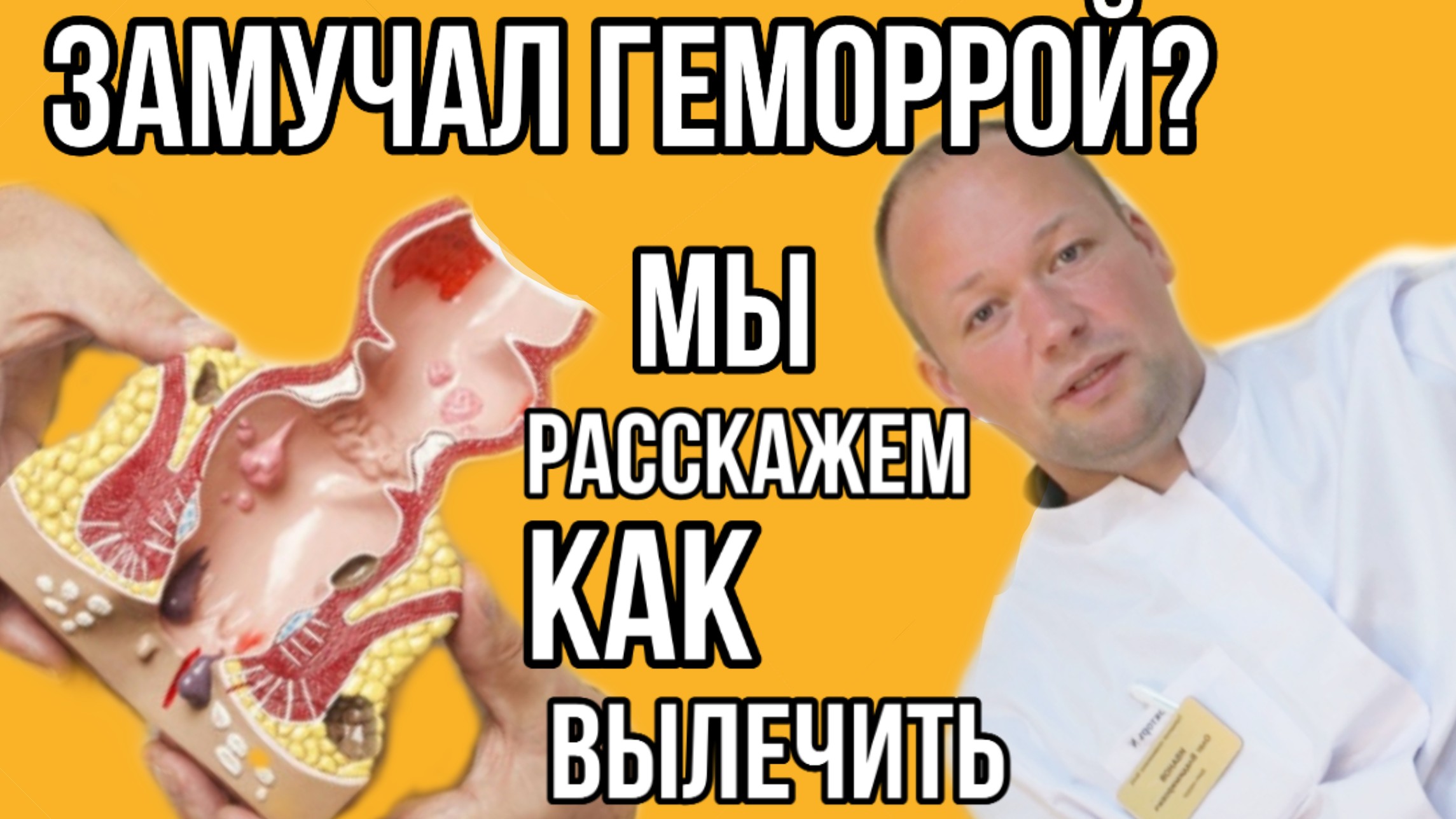 Колопроктолог о геморроидальной болезни (геморрой)