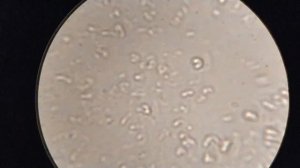 Кровь после цикория