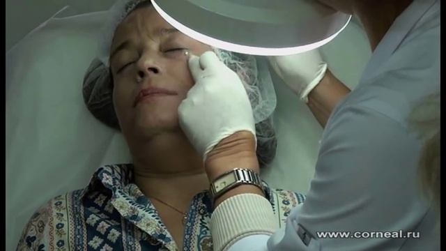 Филлер плюс мезонити? - можно! смотреть онлайн