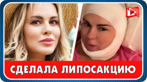 Анна Семенович сделала липосакцию и убрала второй подбородок