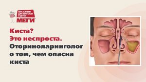 Киста? Это неспроста. Оториноларинголог о том, чем опасна киста