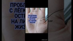 Проблемы с лёгкими: остров на линии жизни