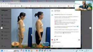 Подкаст "Массаж при сутулости НЕ поможет…  "