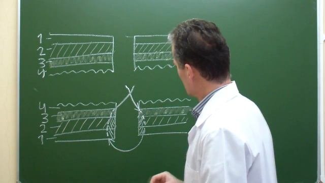 Схема однорядного шва Матешука