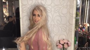 Система волос. Демонстрация системы замещения волос