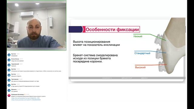 Как позиционировать брекеты для эффективного лечения?