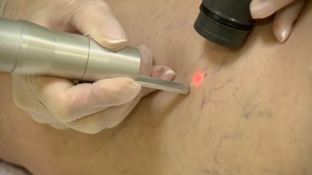 # 12 Ноябрьск Косметологический кабинет Удаление капилляров смотреть онлайн