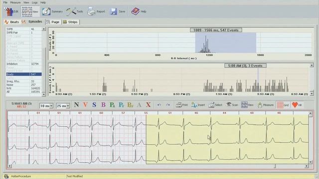Holter Pulse Biomedical PBI Cardiology Suite Training 1 смотреть онлайн