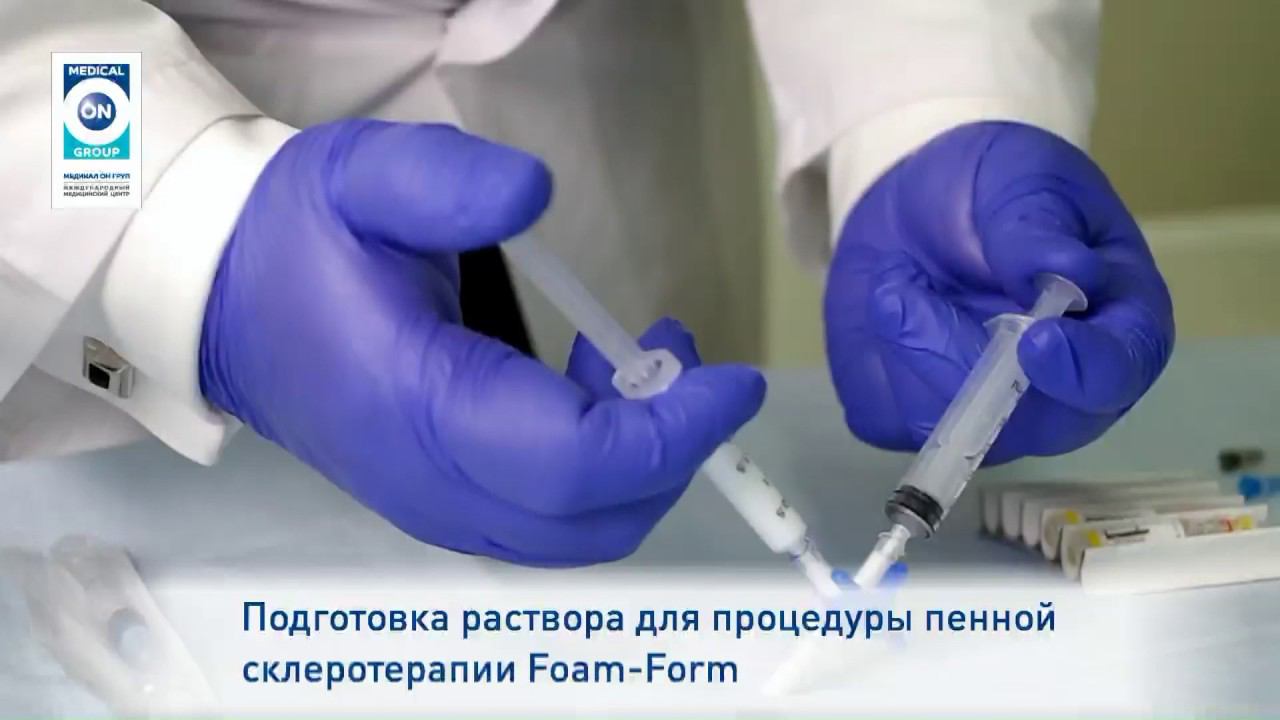 Операция методом склеротерапии - Medical On Group - Подмосковье.