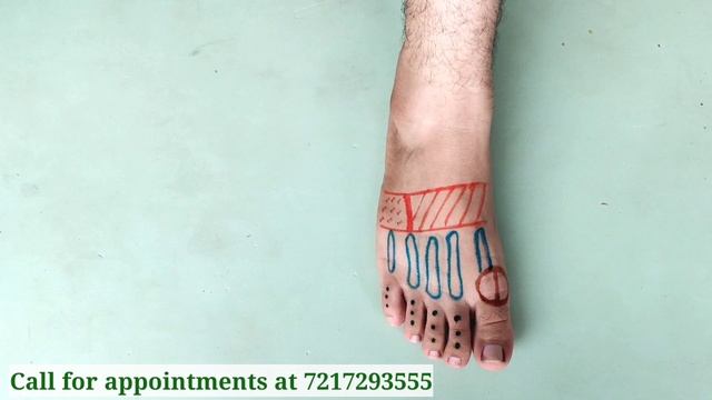 पैर के पंजे और पैर की उंगलियों का दर्द | Foot and toe pain |Dr. vivek Gaur Physiotherapist смотреть онлайн