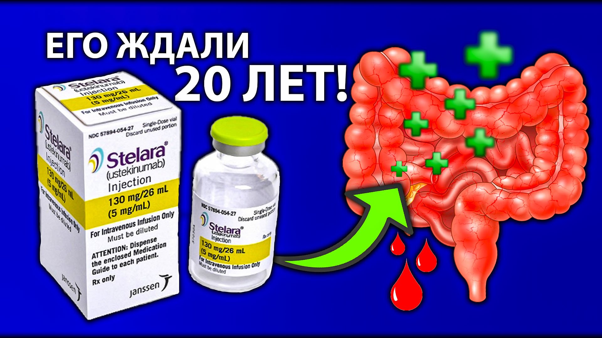 Лекарство от кишечного колита. Таблетки от колита кишечника. Лекарства при спастическом колите кишечника. Лекарство от язвенного колита кишечника.