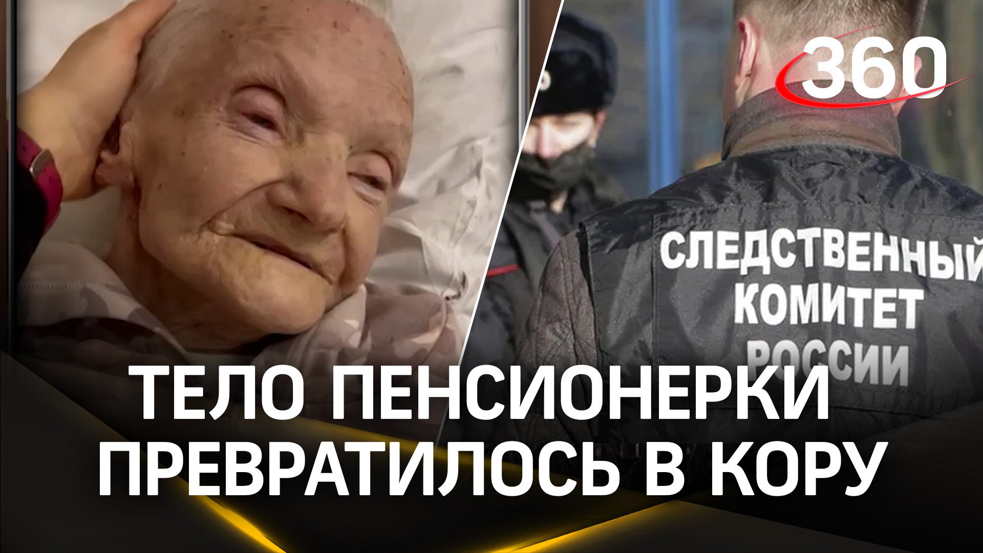 89-летнюю женщину госпитализировали   с чесоткой из дома престарелых