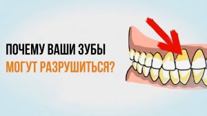 Лечение зубов ✔️ почему Ваши зубы могут разрушиться? Узнайте в видео.