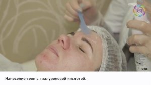 Лазерная биоревитализация лица | Процедура Роял Медик