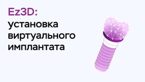 Возможности программы Ez3D: установка виртуального имплантата