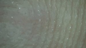 Кожа человека под цифровой лупой