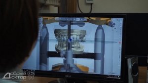 Технология 3D - моделирования зубов. Цифровая модель зубов пациента.