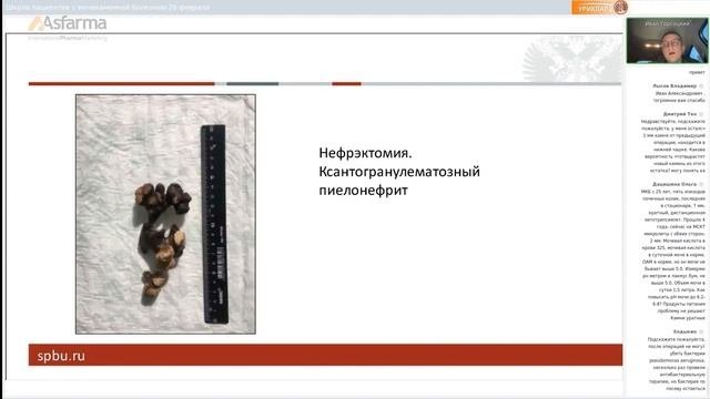 Инфекционные камни. Этиопатогенез и возможности терапии