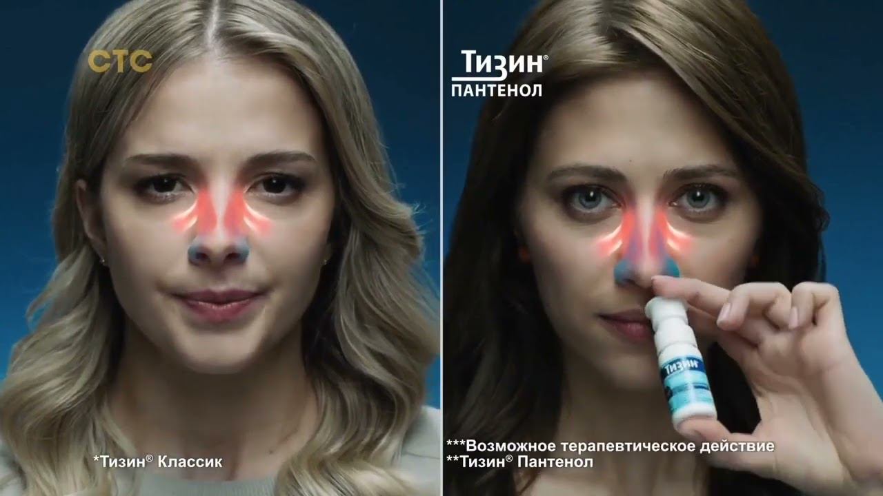 Реклама Тизин смотреть онлайн