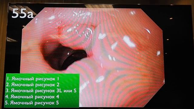 10 Тест по классификации Kudo смотреть онлайн